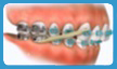 Orthodontics