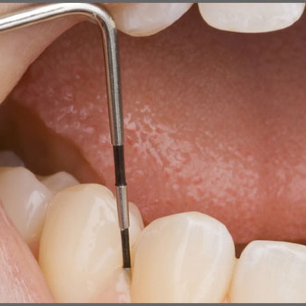 What is periodontitis and what is a periodontist?