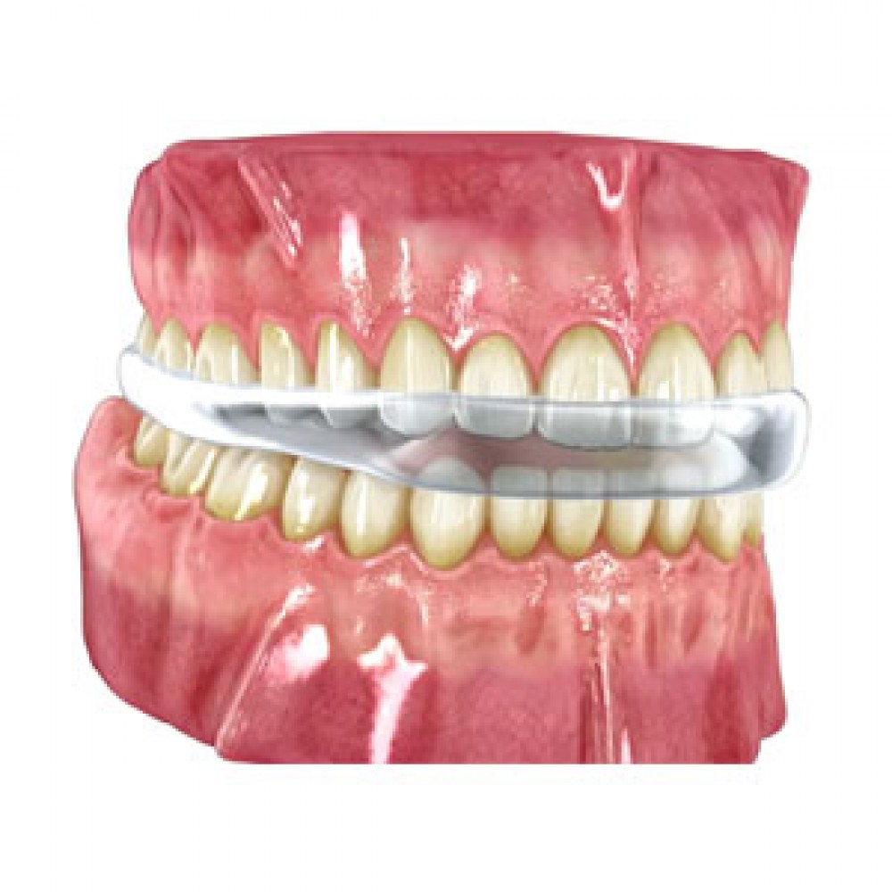 Bruxism, Snoring & Sleep Apnea Splint