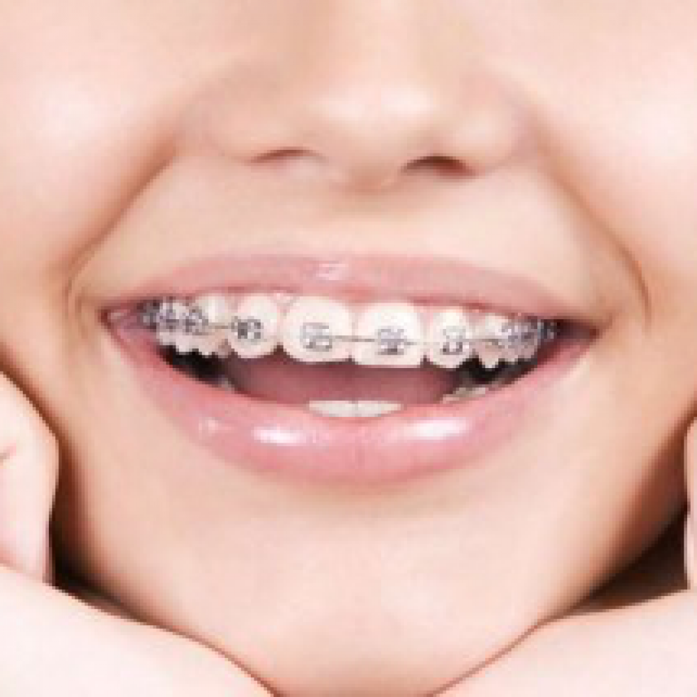 At what age should my child visit an orthodontist?